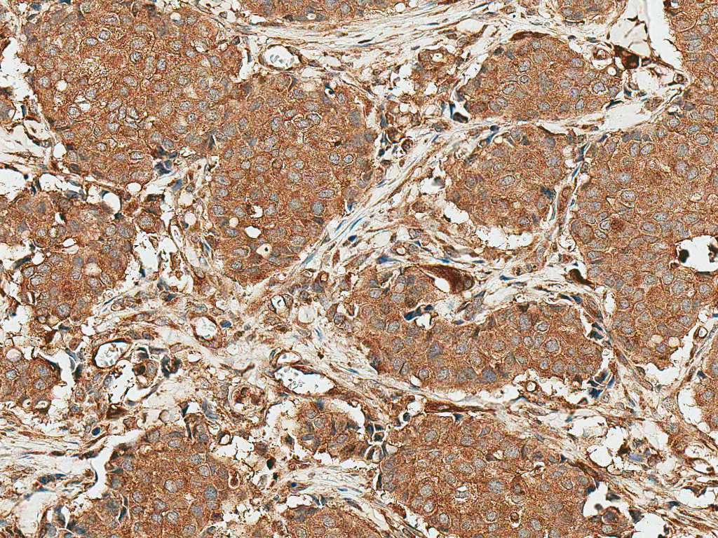  - ROR1 Antibody ASM10611